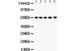 Anti- AGFG1 antibody, Western blotting All lanes: Anti AGFG1  at 0. (AGFG1 抗体  (N-Term))