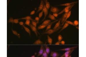 Immunofluorescence analysis of HeLa cells using PSMD13 Polyclonal Antibody at dilution of 1:100 (40x lens). (PSMD13 抗体)