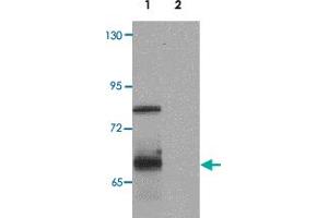 Western blot analysis of ORMDL1 in SK-N-SH Cell lysate with ORMDL1 polyclonal antibody  at 1 ug/mL (lane 1) and 2 ug/mL (lane 2). (ORMDL1 抗体)