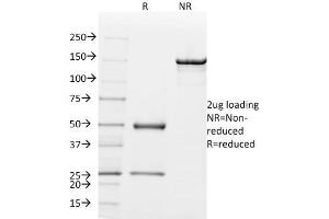 SDS-PAGE (SDS) image for anti-Secretoglobin, Family 2A, Member 2 (SCGB2A2) antibody (ABIN6940036)
