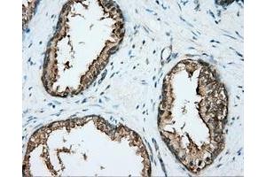 Immunohistochemical staining of paraffin-embedded liver tissue using anti-DNTTIP1 mouse monoclonal antibody. (DNTTIP1 抗体)