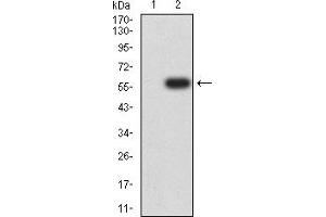 Western Blotting (WB) image for anti-Succinate Dehydrogenase Complex, Subunit B, Iron Sulfur (Ip) (SDHB) (AA 29-280) antibody (ABIN7193552)