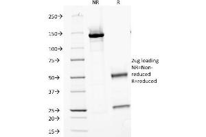 SDS-PAGE Analysis Purified MVP Monoclonal Antibody (Clone 1014). (MVP 抗体)