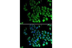 Immunofluorescence analysis of U2OS cells using PIWIL1 antibody (ABIN6293460). (PIWIL1 抗体)
