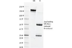 SDS-PAGE Analysis Purified Connexin 32 Mouse Monoclonal Antibody (Clone M12. (GJB1 抗体)
