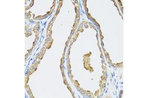 Immunohistochemistry of paraffin-embedded human prostate using CYP19A1 antibody (ABIN5971188) at dilution of 1/100 (40x lens). (Aromatase 抗体)