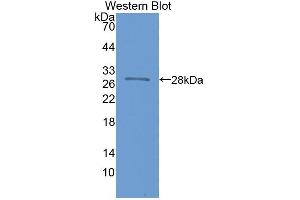 Detection of Recombinant NOS1AP, Human using Polyclonal Antibody to Nitric Oxide Synthase 1 Adaptor Protein (NOS1AP) (NOS1AP 抗体  (AA 285-506))