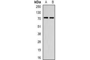 Western blot analysis of METTL3 expression in HepG2 (A), mouse spleen (B) whole cell lysates. (METTL3 抗体)