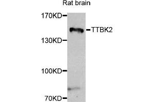 Western blot analysis of extracts of rat brain, using TTBK2 antibody. (TTBK2 抗体)