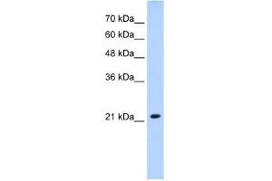 Western Blotting (WB) image for anti-Solute Carrier Family 25 (Mitochondrial Carrier, Brain), Member 14 (SLC25A14) antibody (ABIN630323)