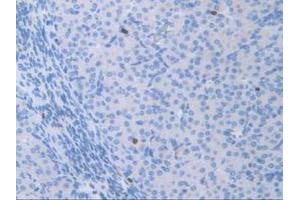 Figure. (ATF6 抗体  (AA 1-377))