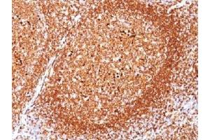 IHC testing of FFPE human tonsil stained with CD79a antibody (clone JCB117). (CD79a 抗体  (AA 202-216))