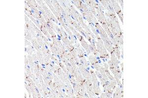 Immunohistochemistry of paraffin-embedded mouse heart using N-Cadherin Rabbit mAb (ABIN7265999) at dilution of 1:100 (40x lens). (N-Cadherin 抗体)