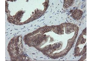 Image no. 5 for anti-Protein Disulfide Isomerase Family A, Member 3 (PDIA3) antibody (ABIN1498107)