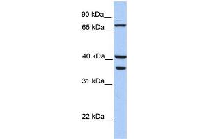 WB Suggested Anti-TGM5 Antibody Titration:  0. (Transglutaminase 5 抗体  (C-Term))