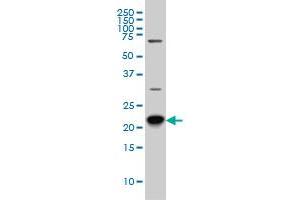 RAB8A monoclonal antibody (M02), clone 3G1 Western Blot analysis of RAB8A expression in Hela S3 NE . (RAB8A 抗体  (AA 108-207))