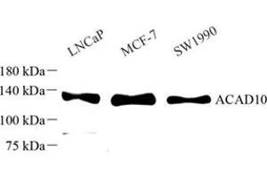 Western blot analysis of ACAD10 (ABIN7072924) at dilution of 1: 500 (ACAD10 抗体)