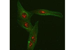 IF analysis of FOXO3A using anti-FOXO3A antibody (ABIN3042404) and anti-Beta Tubulin antibody (ABIN7602743). (FOXO3 抗体  (AA 471-673))