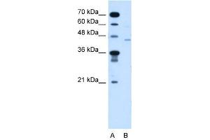 FKTN antibody used at 5 ug/ml to detect target protein. (Fukutin 抗体  (N-Term))