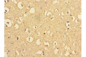 Immunohistochemistry of paraffin-embedded human brain tissue using ABIN7164264 at dilution of 1:100 (Presenilin 1 抗体  (AA 4-218))
