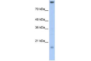 WB Suggested Anti-CLDN11 Antibody Titration:  0. (Claudin 11 抗体  (C-Term))