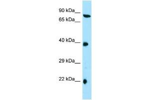 Western Blotting (WB) image for anti-Tetratricopeptide Repeat Domain 4 (TTC4) (C-Term) antibody (ABIN2790316) (TTC4 抗体  (C-Term))