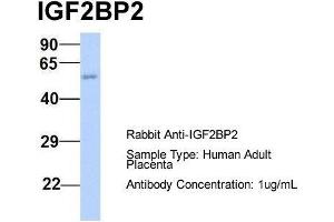 Host:  Rabbit  Target Name:  IGF2BP2  Sample Type:  Human Adult Placenta  Antibody Dilution:  1. (IGF2BP2 抗体  (Middle Region))