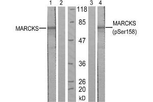 Western blot analysis of extract from starved NIH/3T3 cells, using MARCKS (Ab-158) antibody (E021285, Lane 1 and 2) and MARCKS (phospho-Ser158) antibody (E011293, Lane 3 and 4). (MARCKS 抗体)