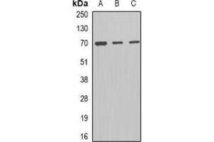 Western blot analysis of MCM-BP expression in A431 (A), mouse spleen (B), mouse liver (C) whole cell lysates. (MCMBP 抗体)