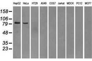 Western blot analysis of extracts (35 µg) from 9 different cell lines by using anti-PDE10A monoclonal antibody. (PDE10A 抗体)