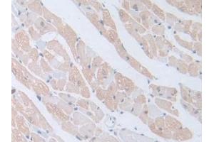 Detection of GnRH in Mouse Cardiac Muscle Tissue using Polyclonal Antibody to Gonadotropin Releasing Hormone (GnRH)