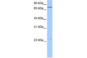 WB Suggested Anti-BFSP1 Antibody Titration:  0. (Filensin 抗体  (N-Term))