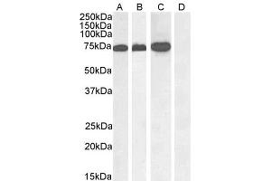 Western Blotting (WB) image for anti-Rac GTPase Activating Protein 1 (RACGAP1) (C-Term) antibody (ABIN184690)