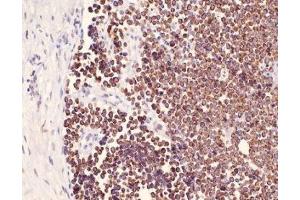Immunohistochemistry (IHC) image for anti-Keratin 25 (KRT25) (C-Term) antibody (ABIN870621) (Keratin 25 抗体  (C-Term))