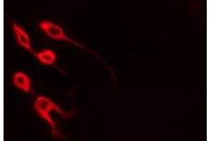 ABIN6277896 staining  Hela cells by IF/ICC. (MYOD1 抗体  (Internal Region))