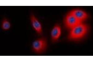 Immunofluorescent analysis of BCAR3 staining in MCF7 cells. (BCAR3 抗体  (C-Term))