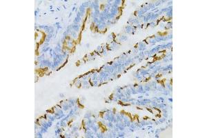 Immunohistochemistry of paraffin-embedded mouse lung using PTGER2 Antibody. (PTGER2 抗体)