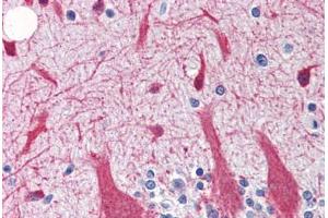Human Brain, Cerebellum (formalin-fixed, paraffin-embedded) stained with SNCG antibody ABIN364362 at 5 ug/ml followed by biotinylated goat anti-rabbit IgG secondary antibody ABIN481713, alkaline phosphatase-streptavidin and chromogen. (SNCG 抗体)