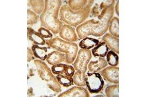 Formalin-fixed and paraffin-embedded human brain tissue reacted with LRRC4 Antibody (C-term) followed which was peroxidase-conjugated to the secondary antibody, followed by DAB staining. (LRRC4 抗体  (C-Term))