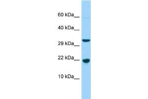 WB Suggested Anti-CABP5 Antibody Titration: 1. (CABP5 抗体  (N-Term))