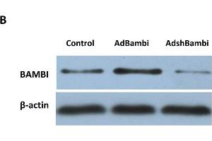 Western Blotting (WB) image for anti-BMP and Activin Membrane-Bound Inhibitor Homolog (BAMBI) (AA 101-200) antibody (ABIN1714490)
