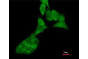 Immunofluorescence analysis of paraformaldehyde-fixed A549, using MMP3 antibody at 1:200 dilution.