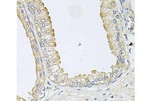 Immunohistochemistry of paraffin-embedded Human prostate using ANKH Polyclonal Antibody at dilution of 1:100 (40x lens). (ANKH 抗体)