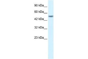 WB Suggested Anti-ANKRD11 Antibody Titration:  1. (ANKRD11 抗体  (N-Term))