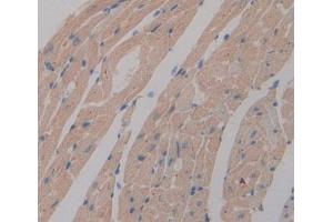 Used in DAB staining on fromalin fixed paraffin- embedded Kidney tissue (PGAM2 抗体  (AA 1-253))