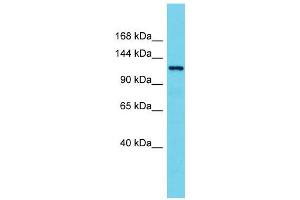 Host:  Rabbit  Target Name:  Hdac7  Sample Type:  Rat Spleen lysates  Antibody Dilution:  1. (HDAC7 抗体  (N-Term))