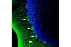 Expression of GPR40/FFAR1 in rat brain - Immunohistochemical staining of rat brain sections using Anti-GPR40/FFAR1 (extracellular) Antibody (ABIN7043137, ABIN7044279 and ABIN7044280). (FFAR1 抗体  (Extracellular))