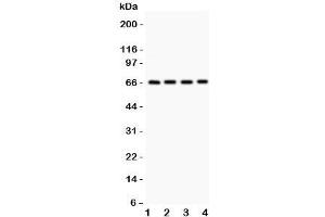 Western blot testing of Optineurin antibody and Lane 1:  HeLa;  2: U87;  3: SMMC;  4: HT1080. (OPTN 抗体  (AA 241-577))