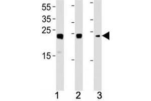 HMGB2 antibody western blot analysis in (1) HL-60, (2) K562, (3) H-4-II-E lysate. (HMGB2 抗体  (AA 92-118))