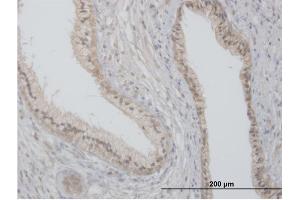 Immunoperoxidase of purified MaxPab antibody to FLOT2 on formalin-fixed paraffin-embedded human prostate.